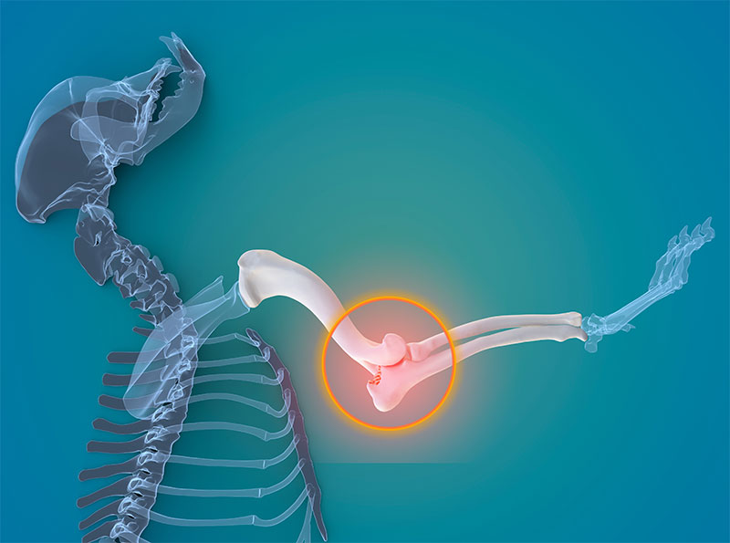 platelet-rich-plasma-joint-injections-strip4